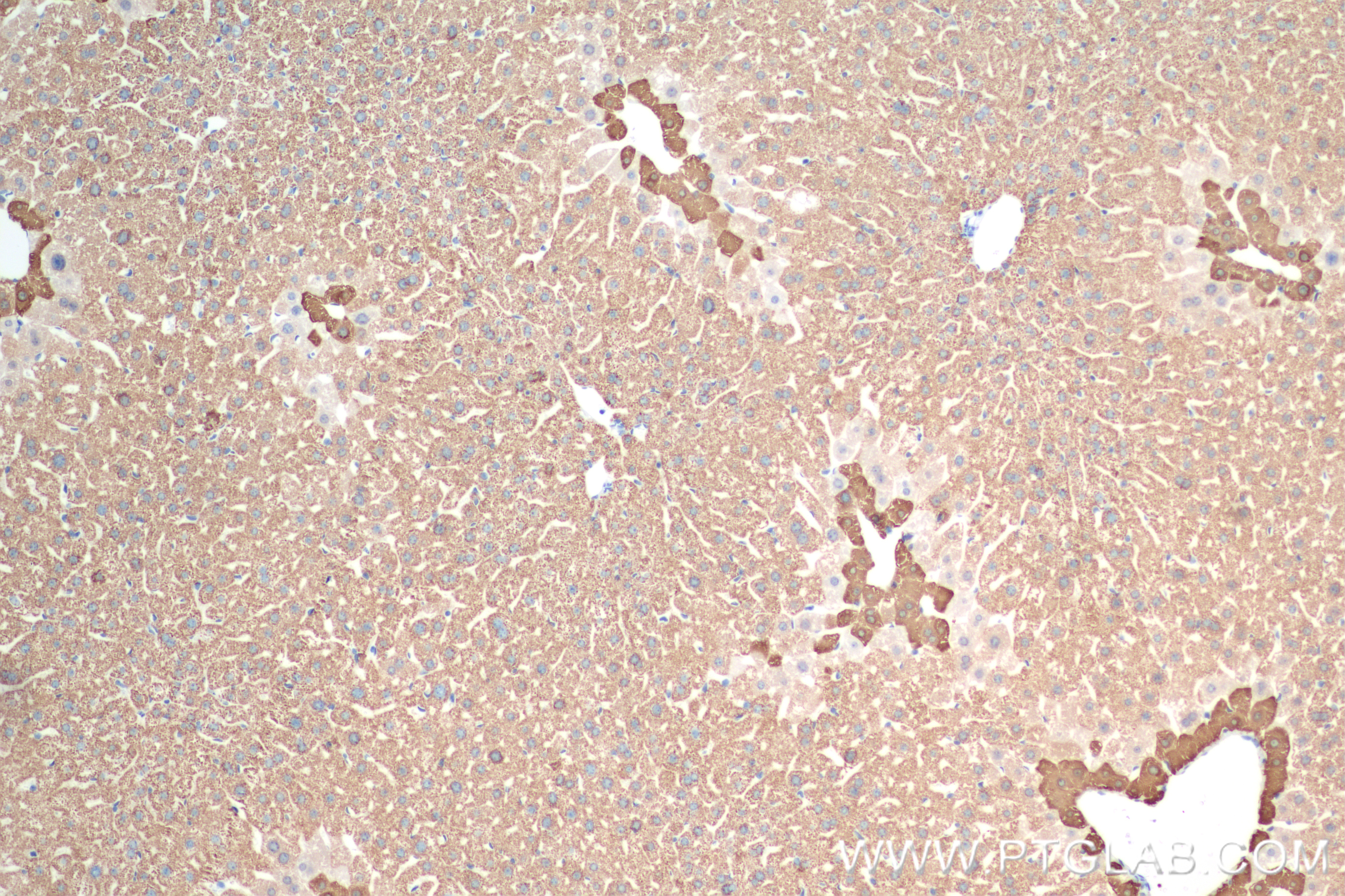 IHC staining of mouse liver using 84277-1-RR (same clone as 84277-1-PBS)