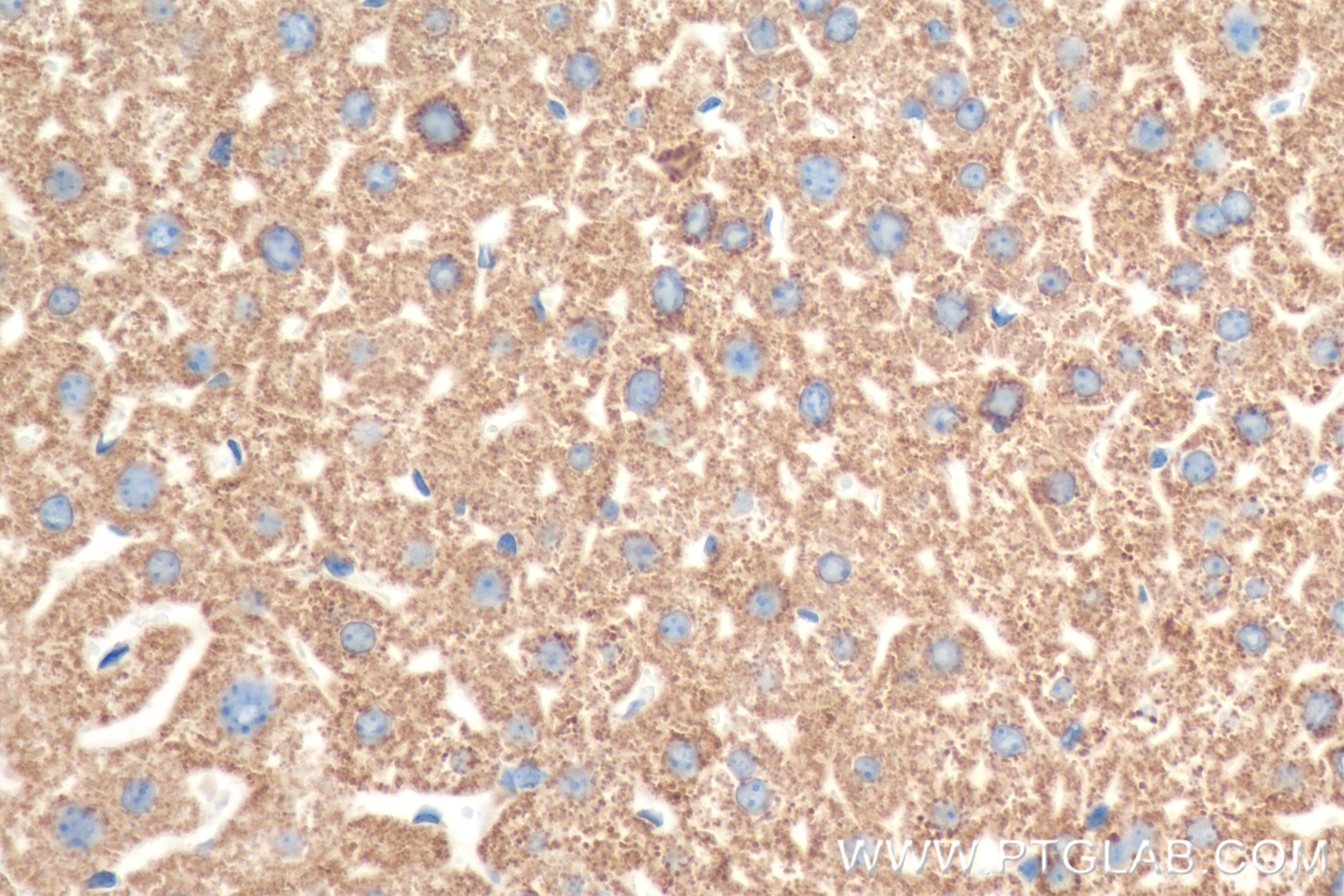 IHC staining of mouse liver using 84277-1-RR (same clone as 84277-1-PBS)