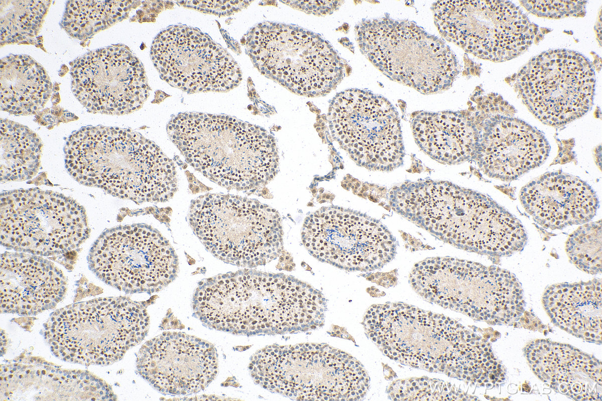 IHC staining of mouse testis using 11031-1-AP