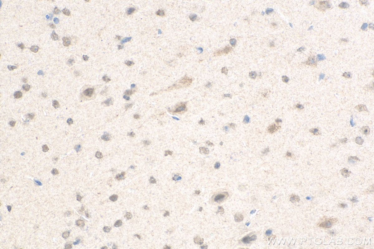 IHC staining of mouse brain using 11031-1-AP