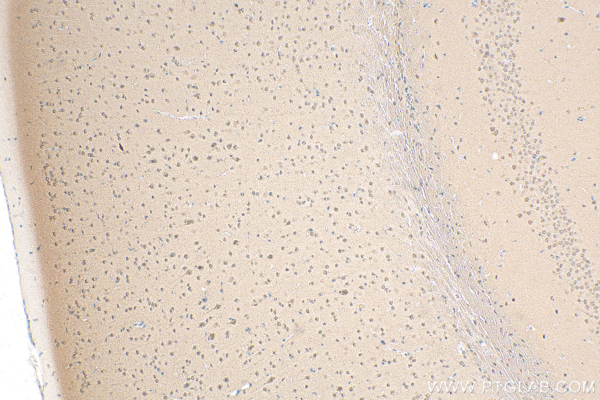 IHC staining of mouse brain using 11031-1-AP