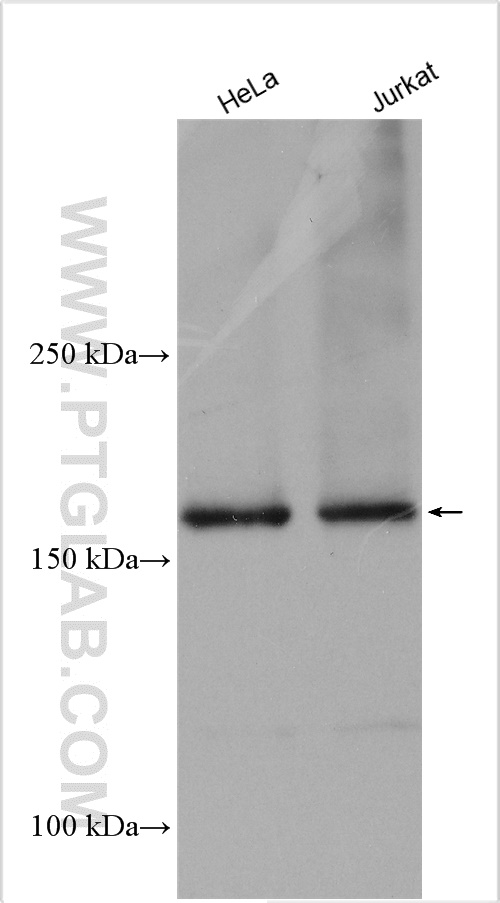 WB analysis using 11031-1-AP