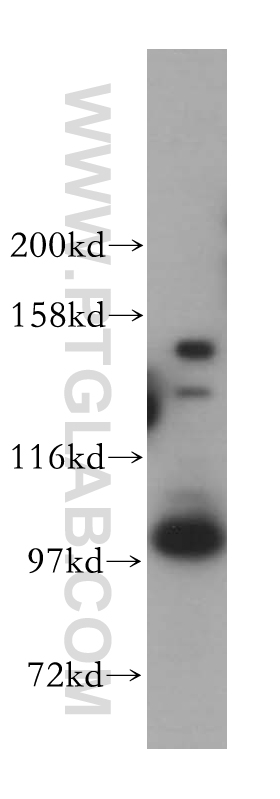 WB analysis of HeLa using 17739-1-AP