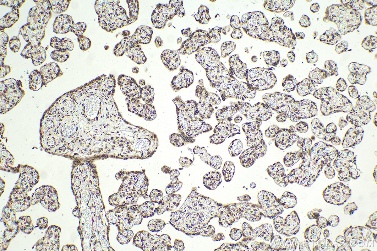 IHC staining of human placenta using 11609-1-AP