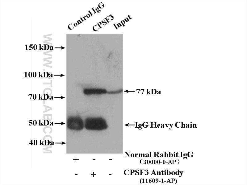 IP experiment of HEK-293 using 11609-1-AP