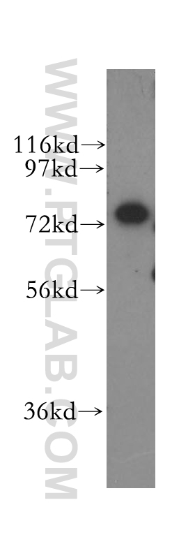 CPSF3 Polyclonal antibody