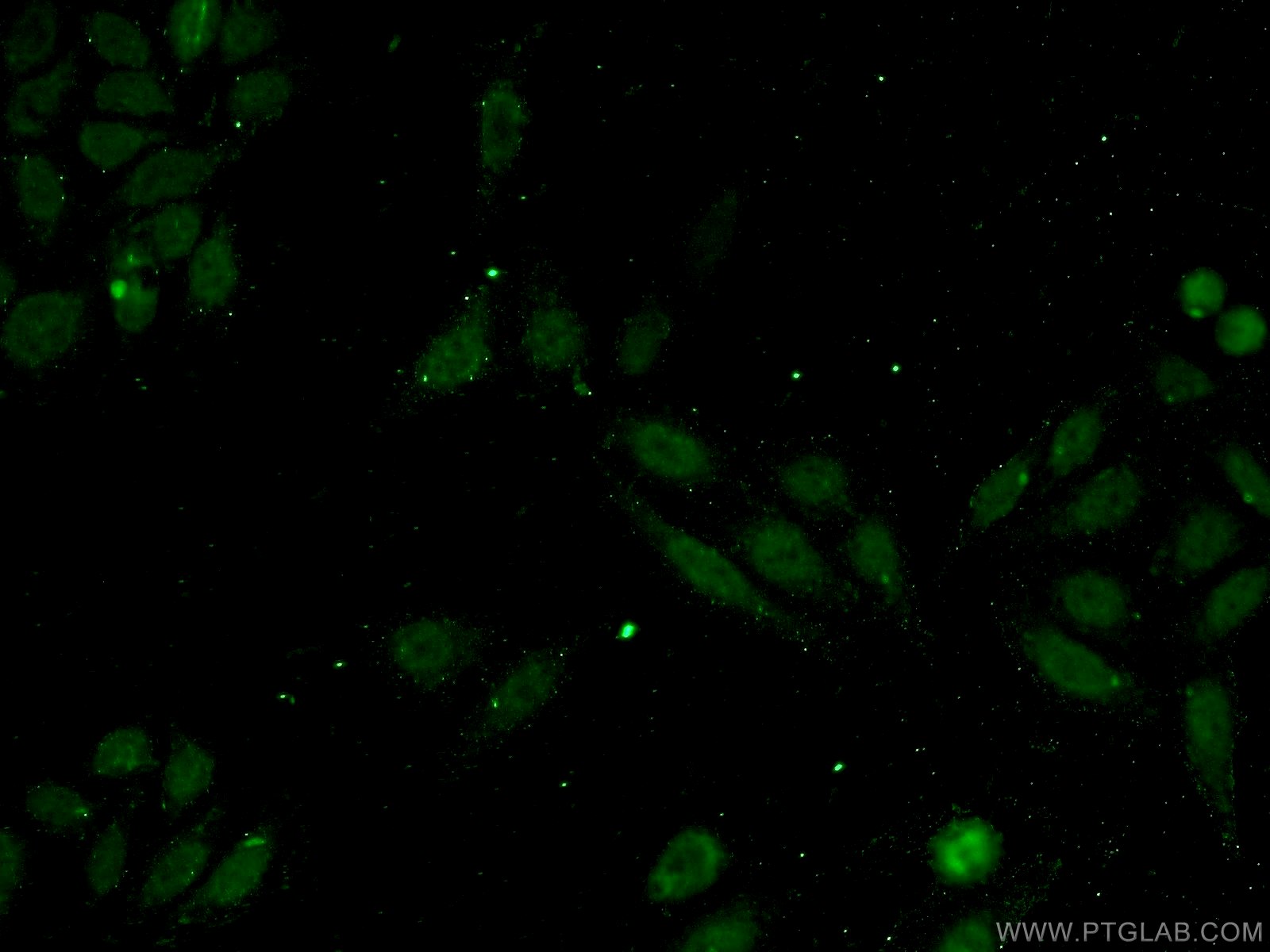 IF Staining of HepG2 using 15860-1-AP