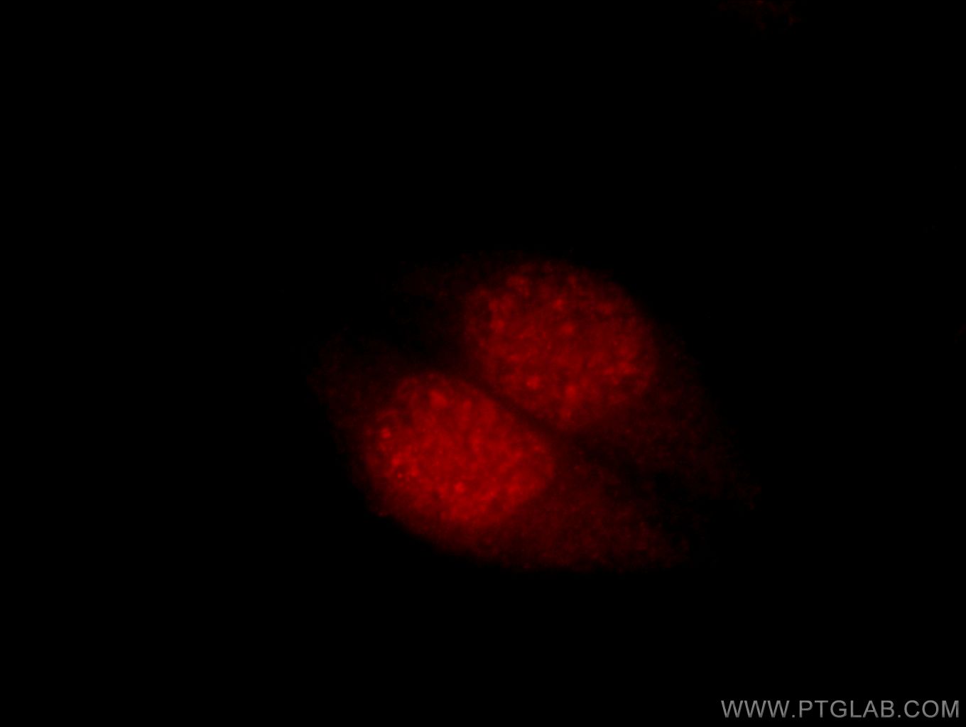 IF Staining of HepG2 using 15023-1-AP