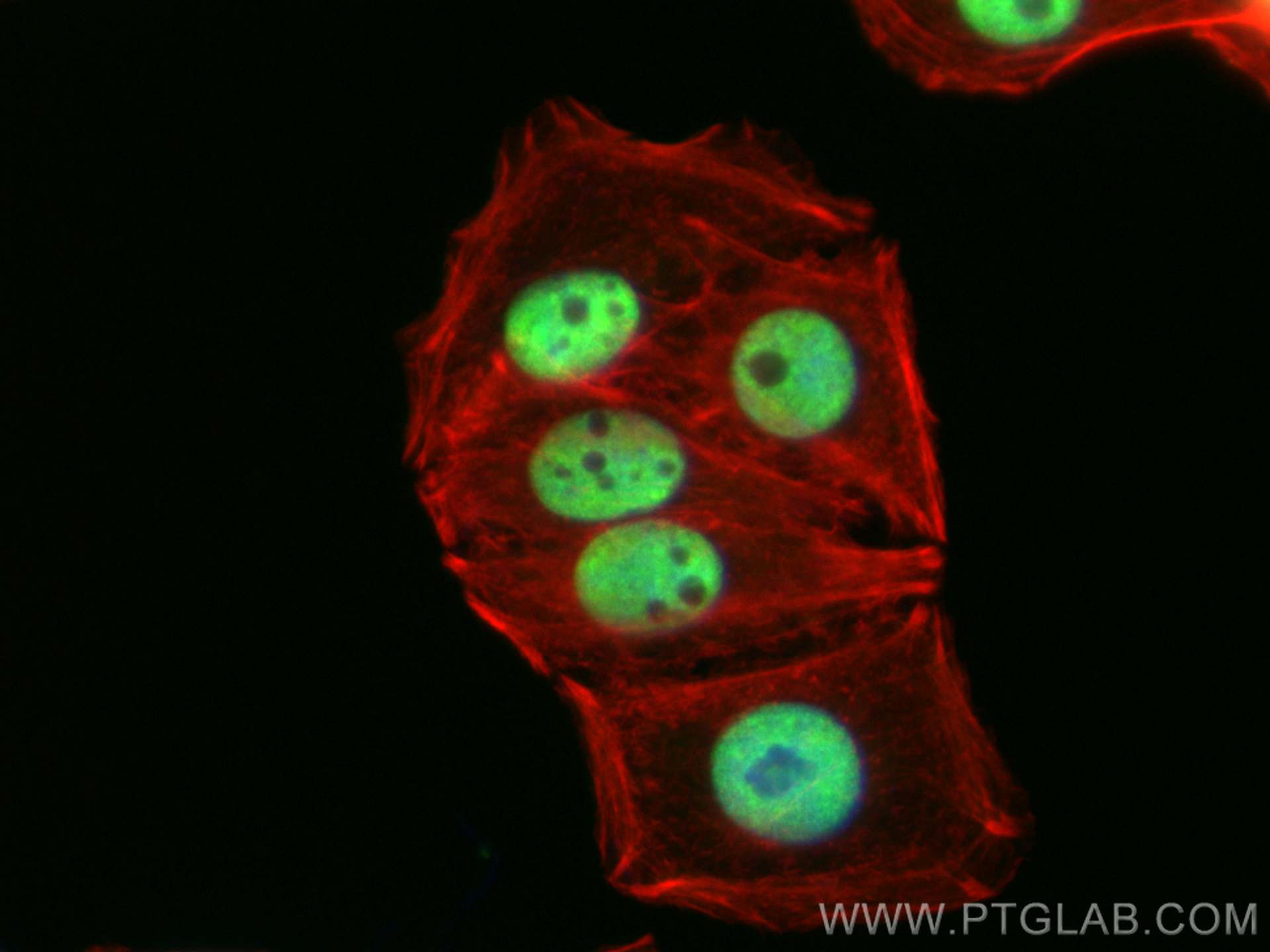 IF Staining of SW480 using 15489-1-AP