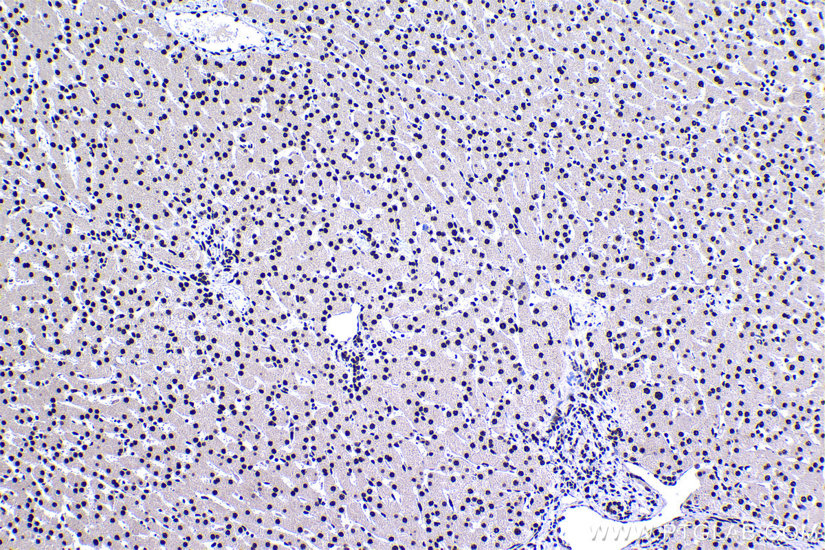 IHC staining of human liver using 15489-1-AP