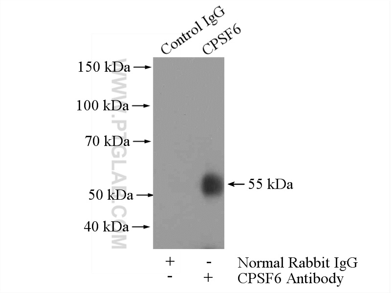 IP experiment of HeLa using 15489-1-AP