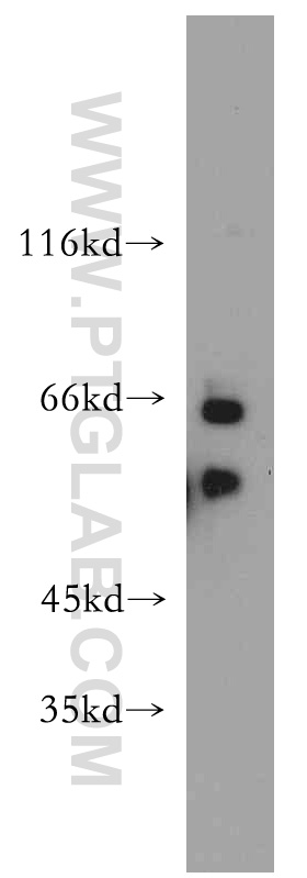 WB analysis of HeLa using 15489-1-AP