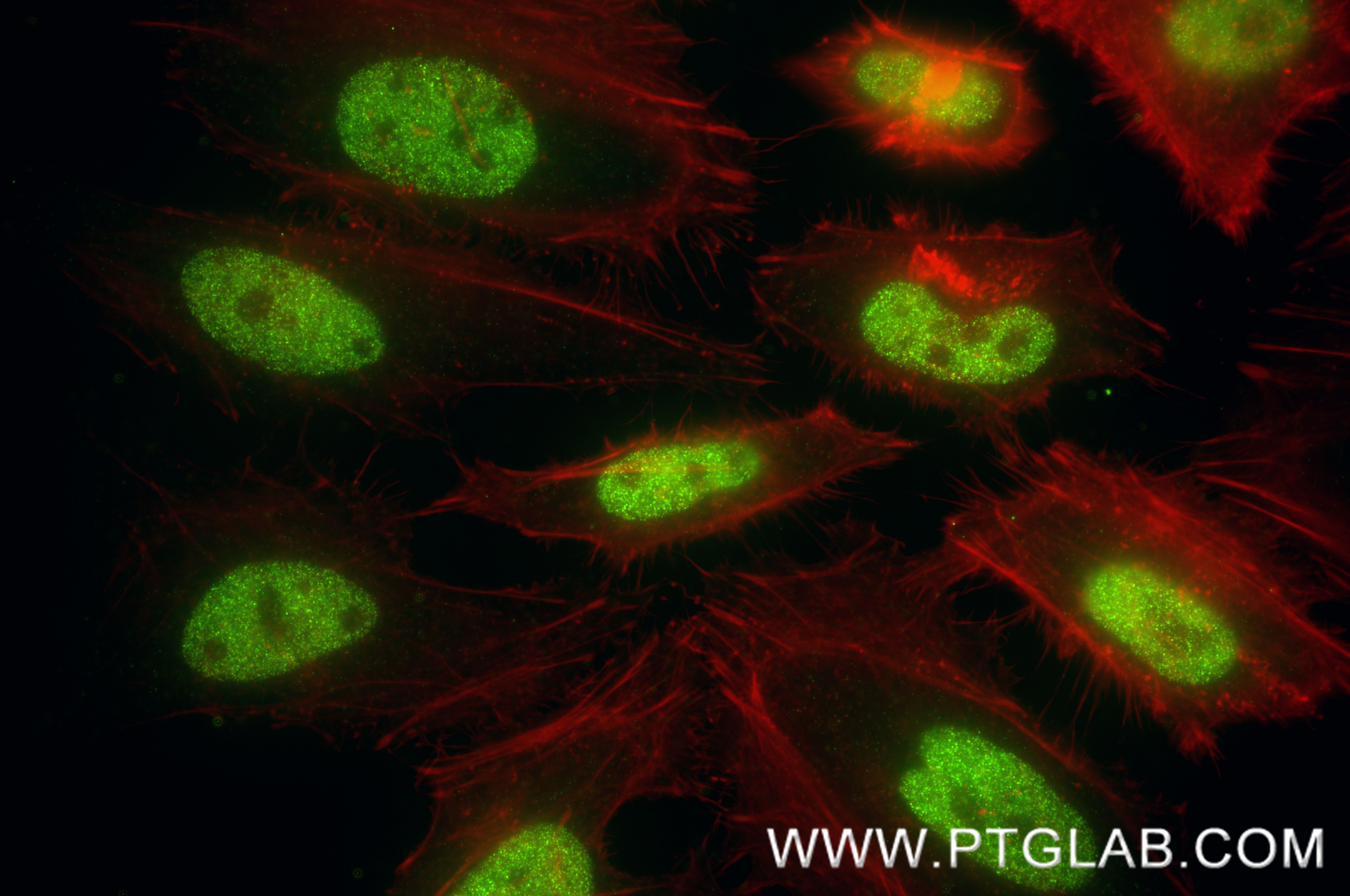 IF Staining of HeLa using 88362-1-RR (same clone as 88362-1-PBS) IF Staining of HeLa using 88362-1-RR (same clone as 88362-1-PBS)