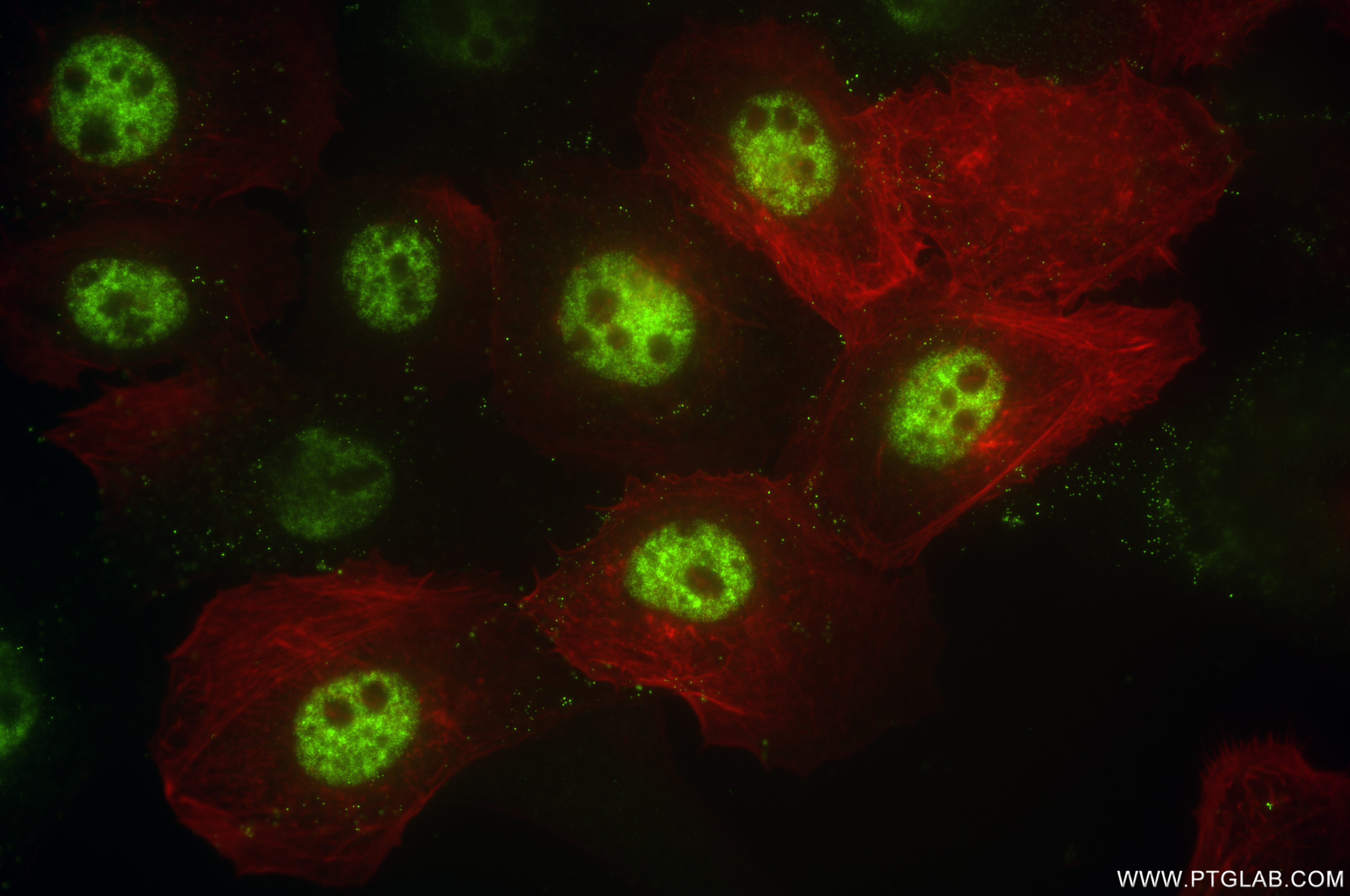 IF Staining of A431 using 85203-1-RR