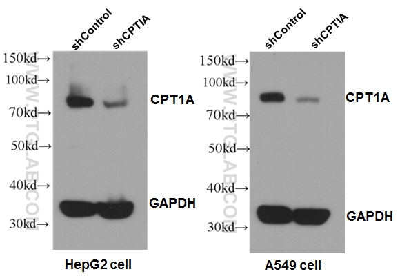 WB analysis of A549 cells using 15184-1-AP