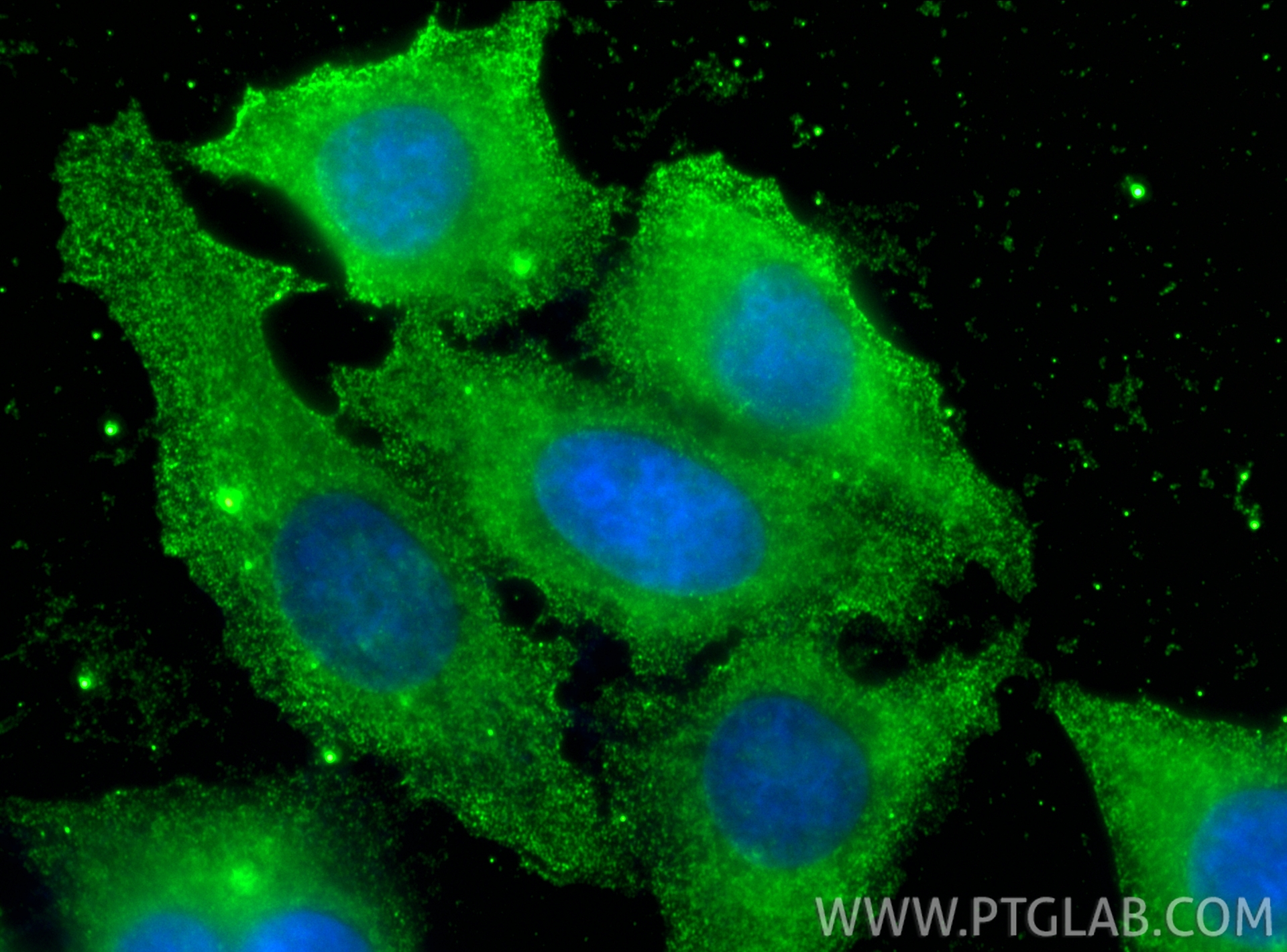 IF Staining of HepG2 using 66039-3-Ig