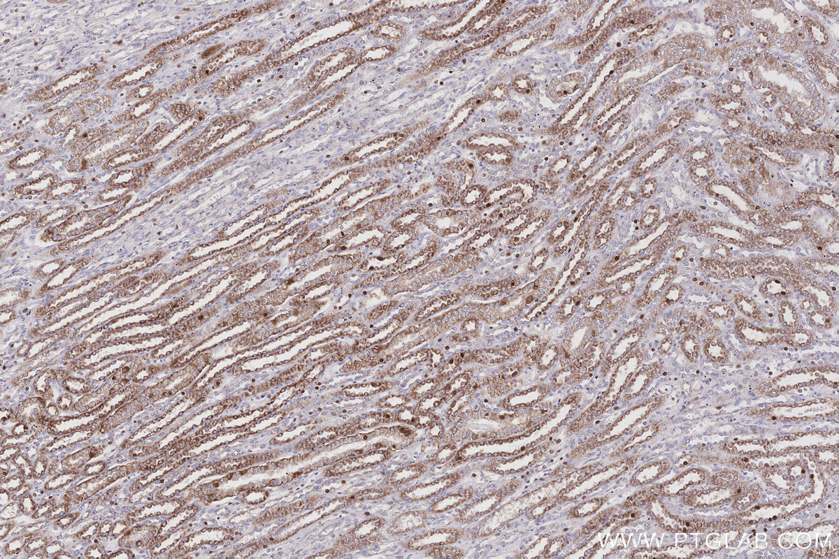 IHC staining of human kidney using 66039-3-Ig