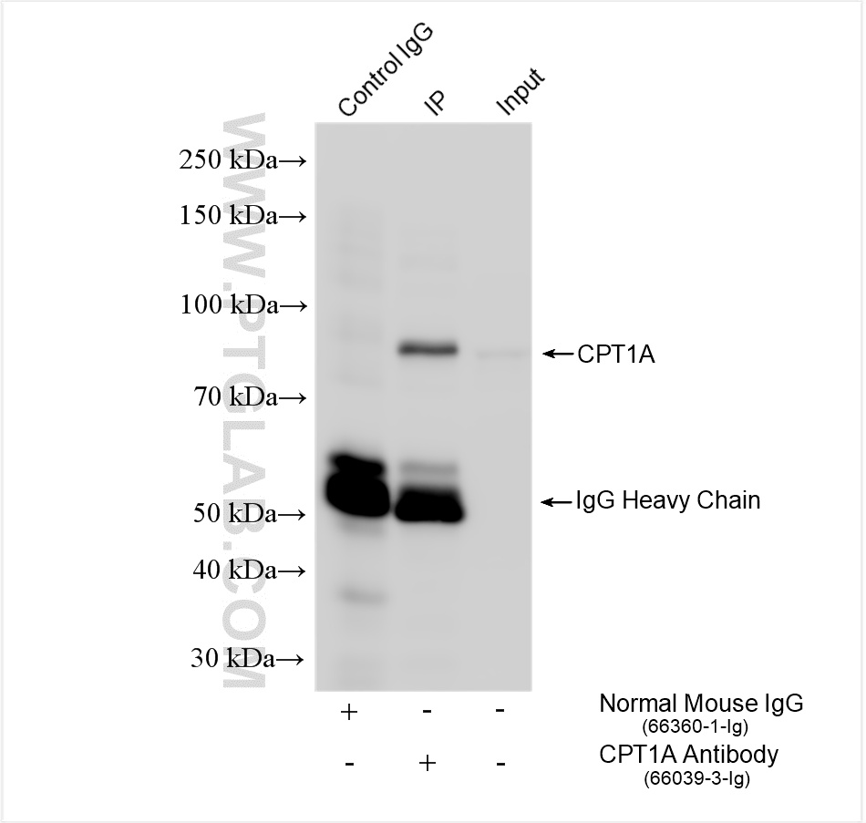 IP experiment of HepG2 using 66039-3-Ig