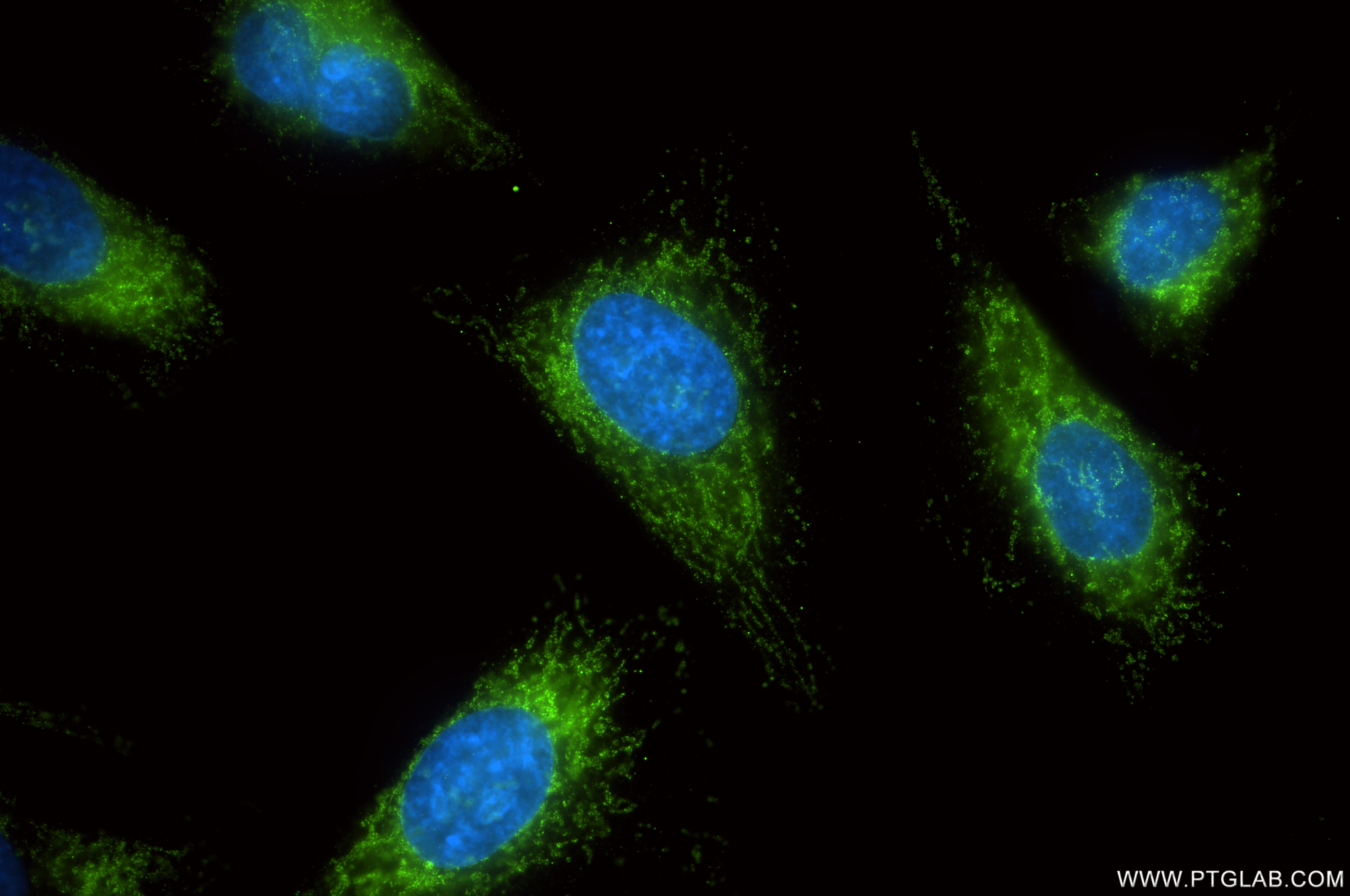 IF Staining of HeLa using 82012-2-RR (same clone as 82012-2-PBS) IF Staining of HeLa using 82012-2-RR (same clone as 82012-2-PBS)