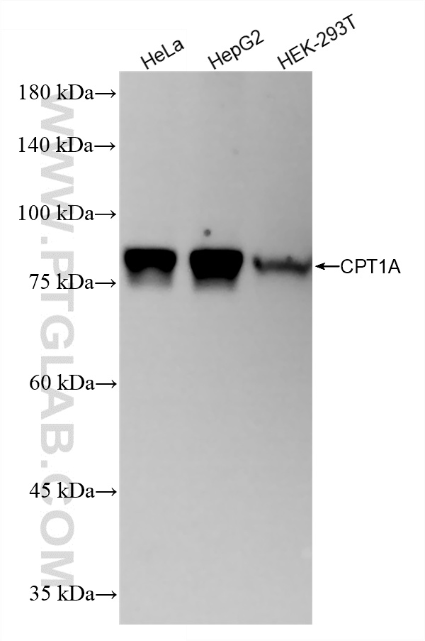 WB analysis using 82012-2-RR (same clone as 82012-2-PBS) WB analysis using 82012-2-RR (same clone as 82012-2-PBS)