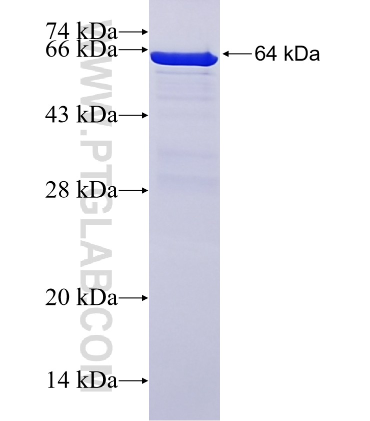 CPT1A fusion protein Ag7202 SDS-PAGE