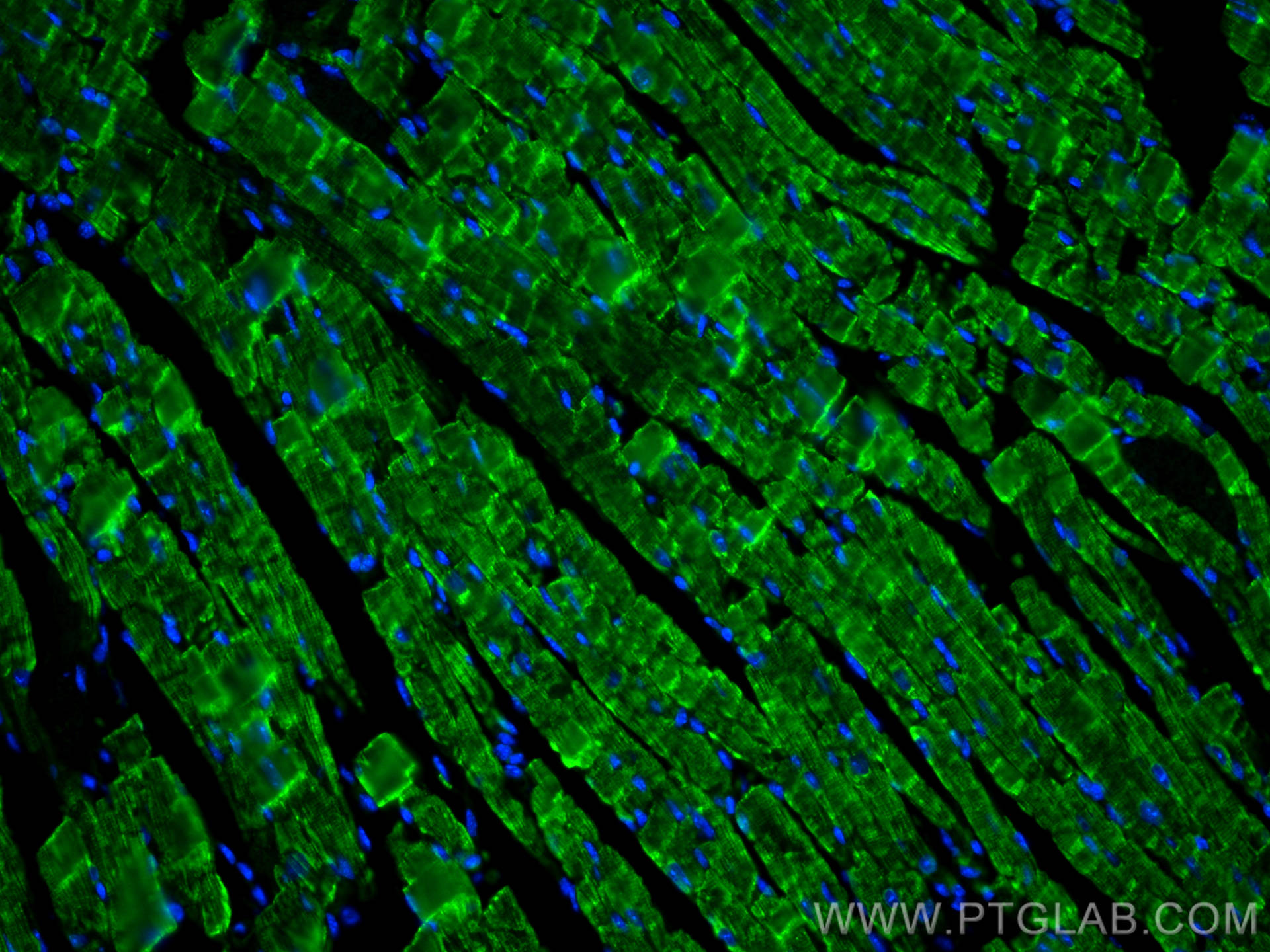IF Staining of mouse heart using 22170-1-AP