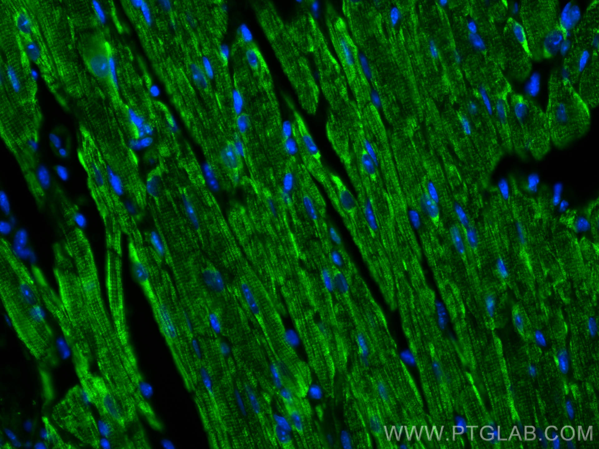 IF Staining of mouse heart using 22170-1-AP