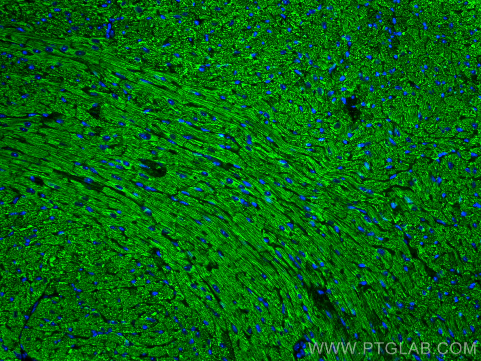 IF Staining of mouse heart using 22170-1-AP