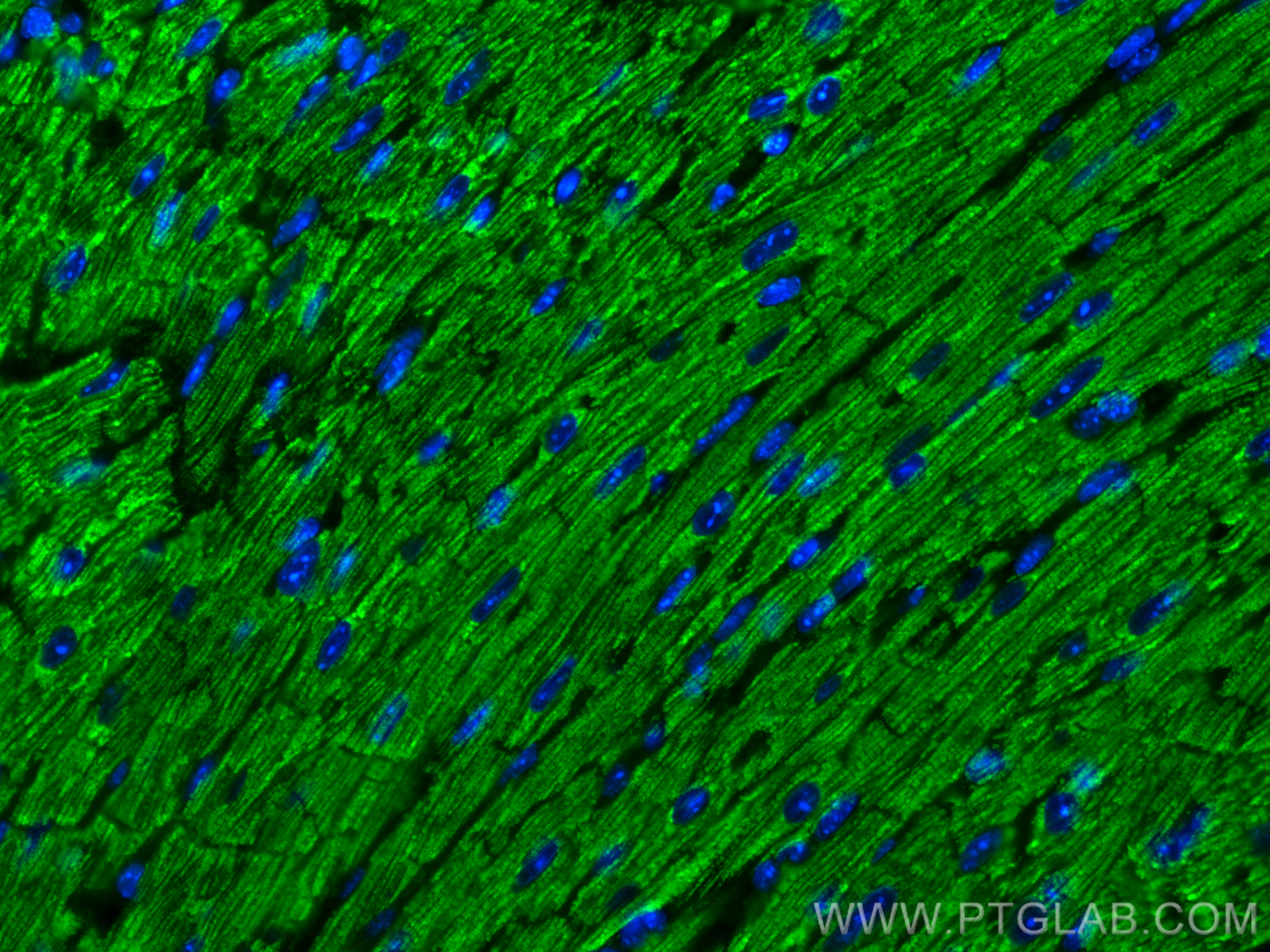IF Staining of mouse heart using 22170-1-AP