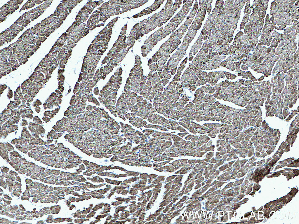 IHC staining of mouse heart using 22170-1-AP