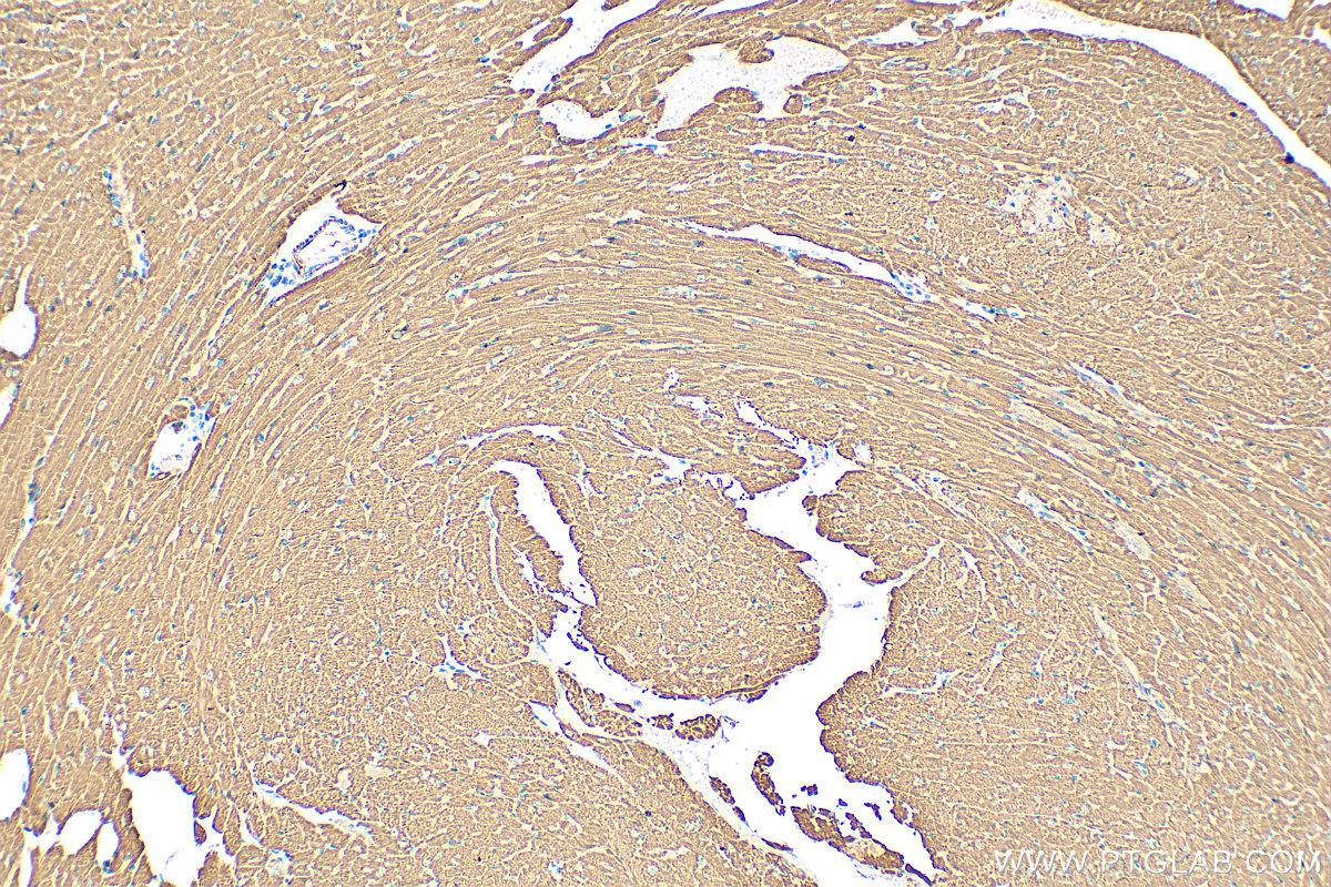 IHC staining of mouse heart using 22170-1-AP