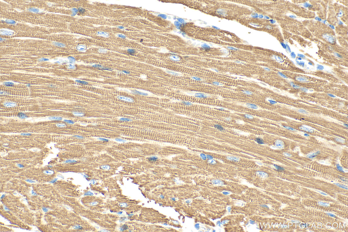 IHC staining of mouse heart using 22170-1-AP
