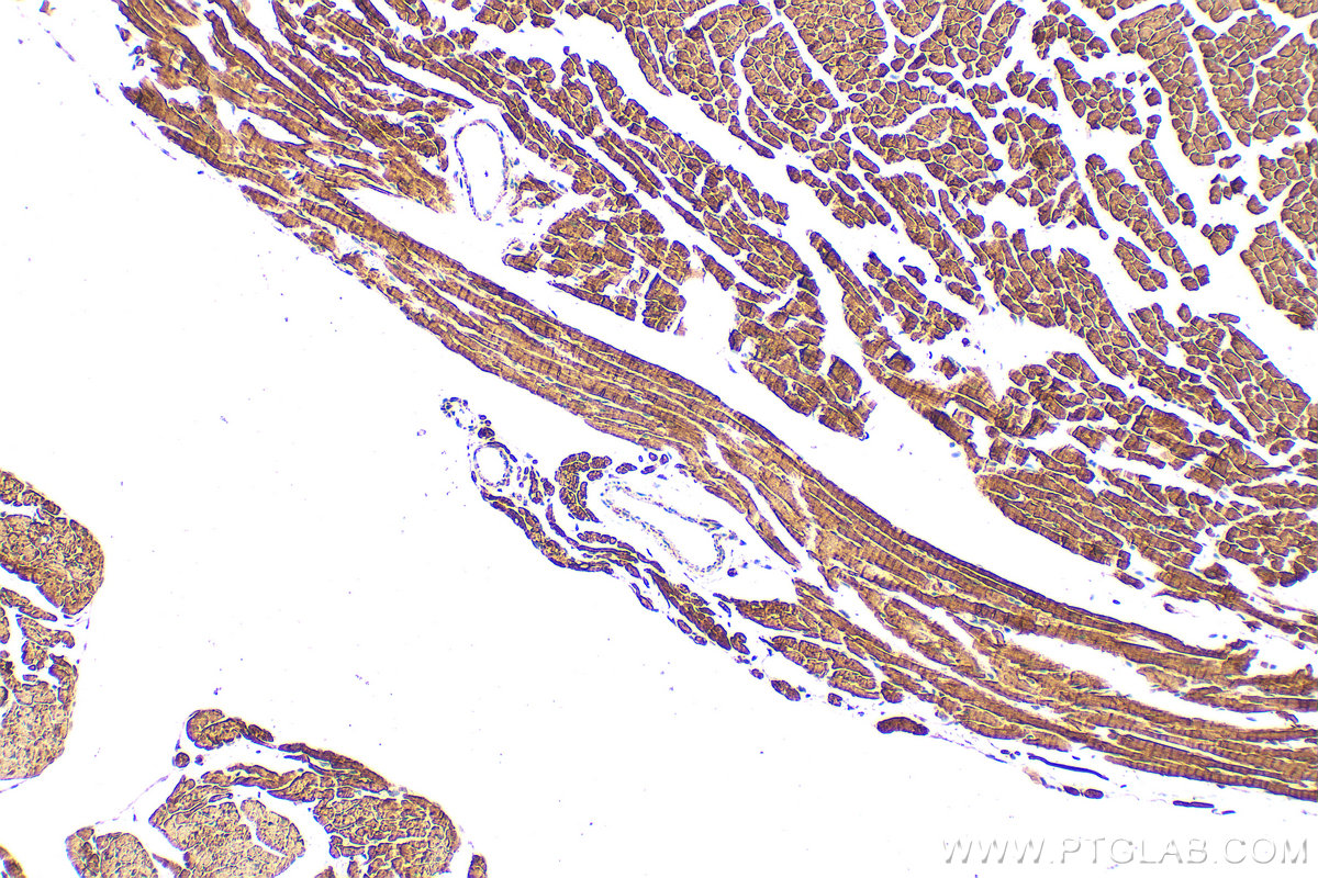 IHC staining of mouse heart using 22170-1-AP