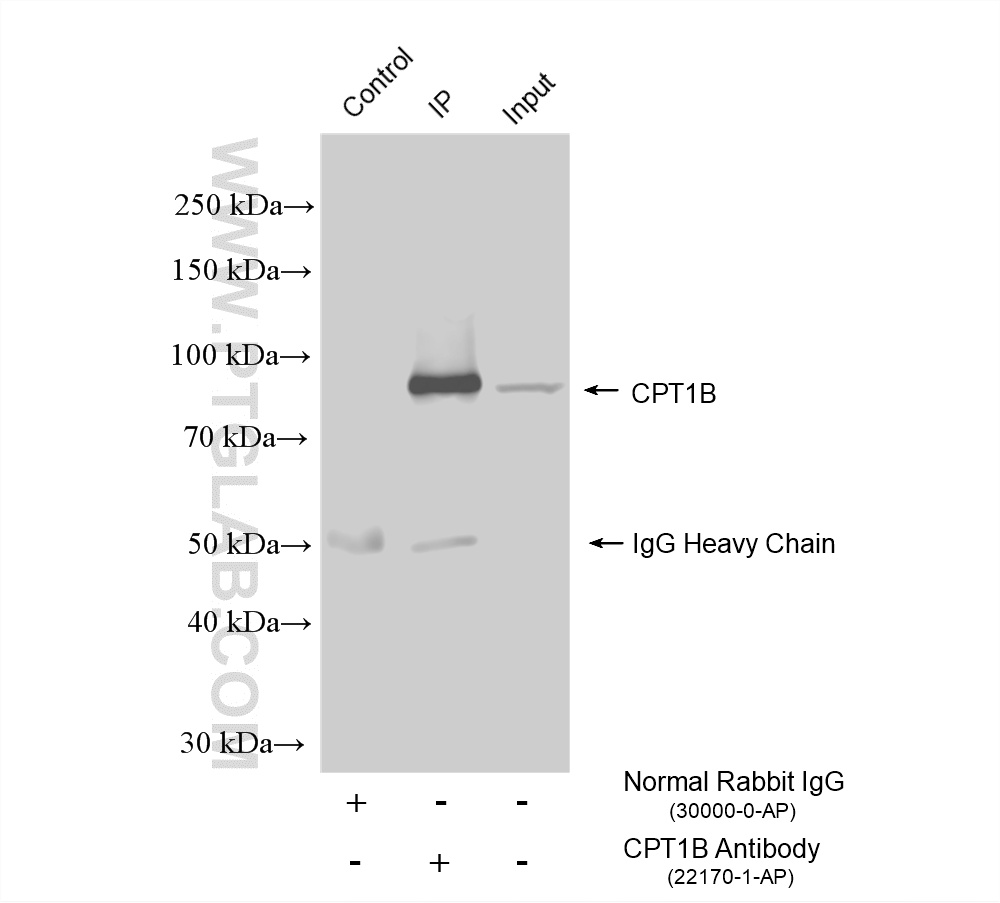 IP experiment of mouse heart using 22170-1-AP