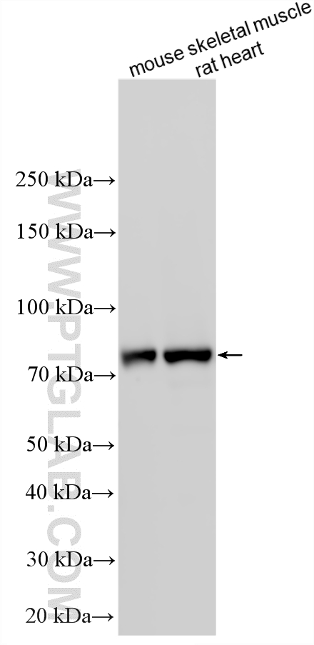 Various lysates were subjected to SDS PAGE followed by western blot with 22170-1-AP (CPT1B-specific antibody) at dilution of 1:80000 incubated at room temperature for 1.5 hours. WB analysis using 22170-1-AP