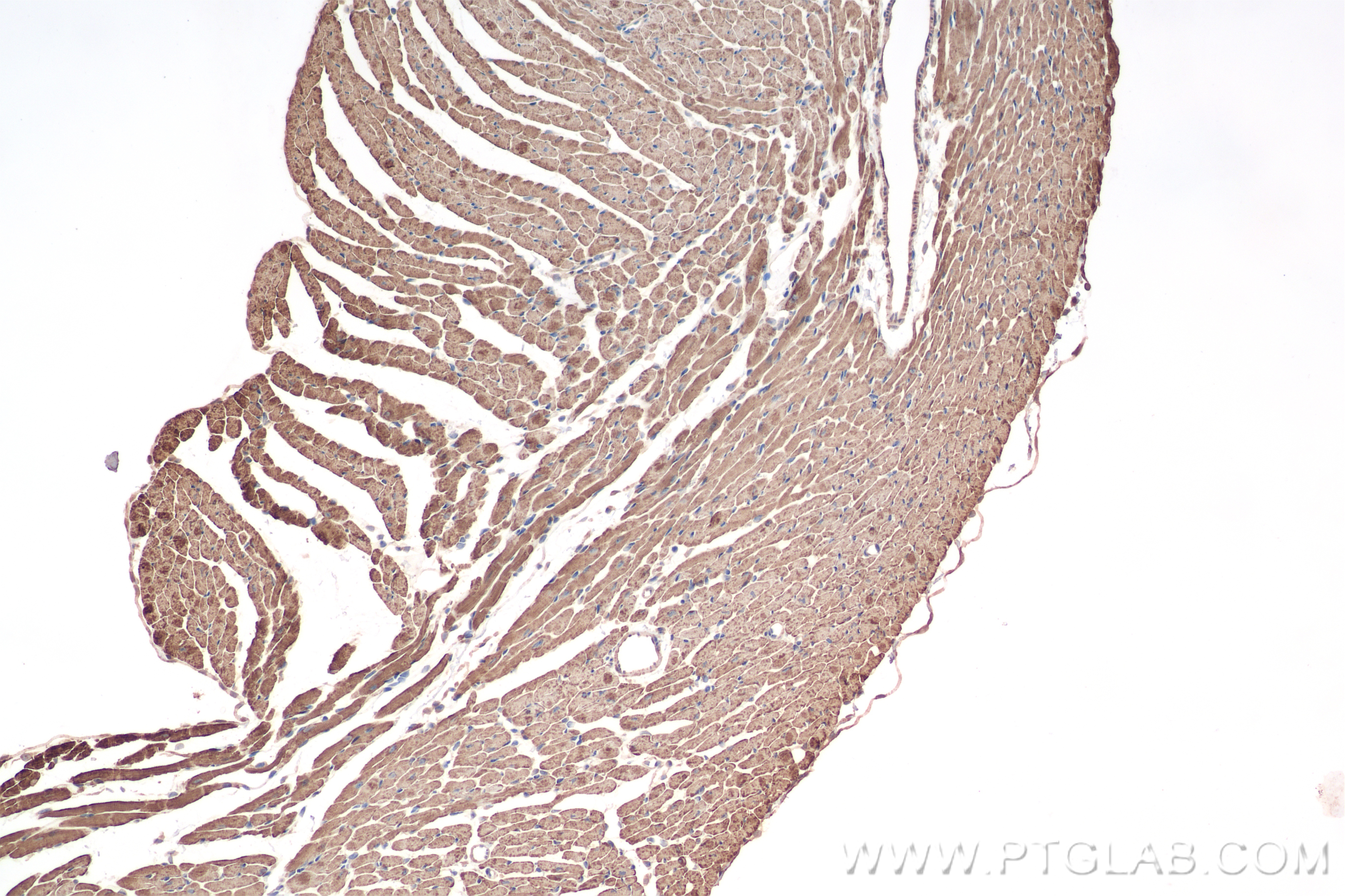 IHC staining of mouse heart using 82701-3-RR (same clone as 82701-3-PBS)