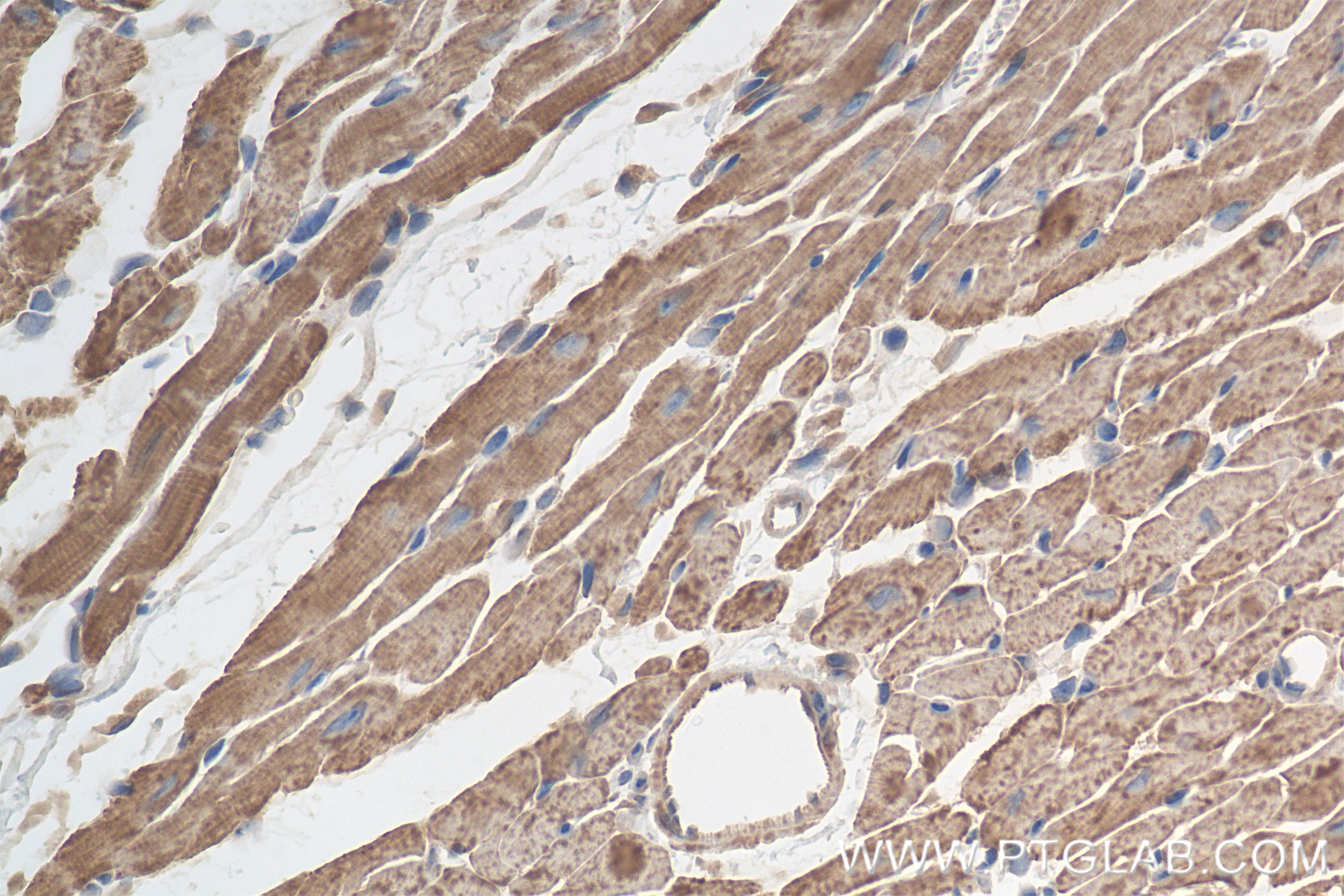 IHC staining of mouse heart using 82701-3-RR (same clone as 82701-3-PBS)