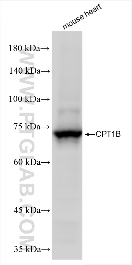 WB analysis of mouse heart using 82701-3-RR (same clone as 82701-3-PBS)
