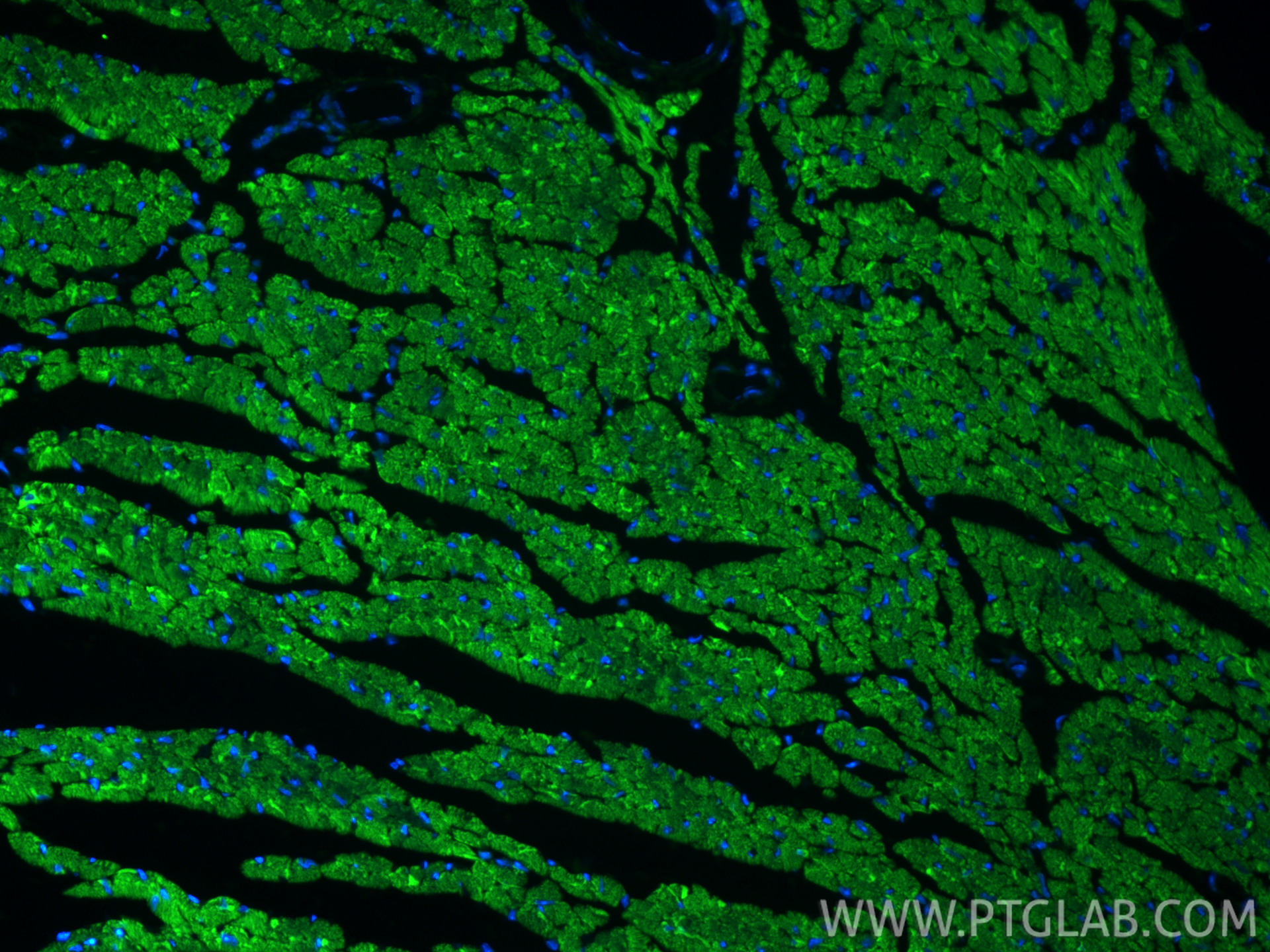 IF Staining of mouse heart using CL488-82701-3 IF Staining of mouse heart using CL488-82701-3