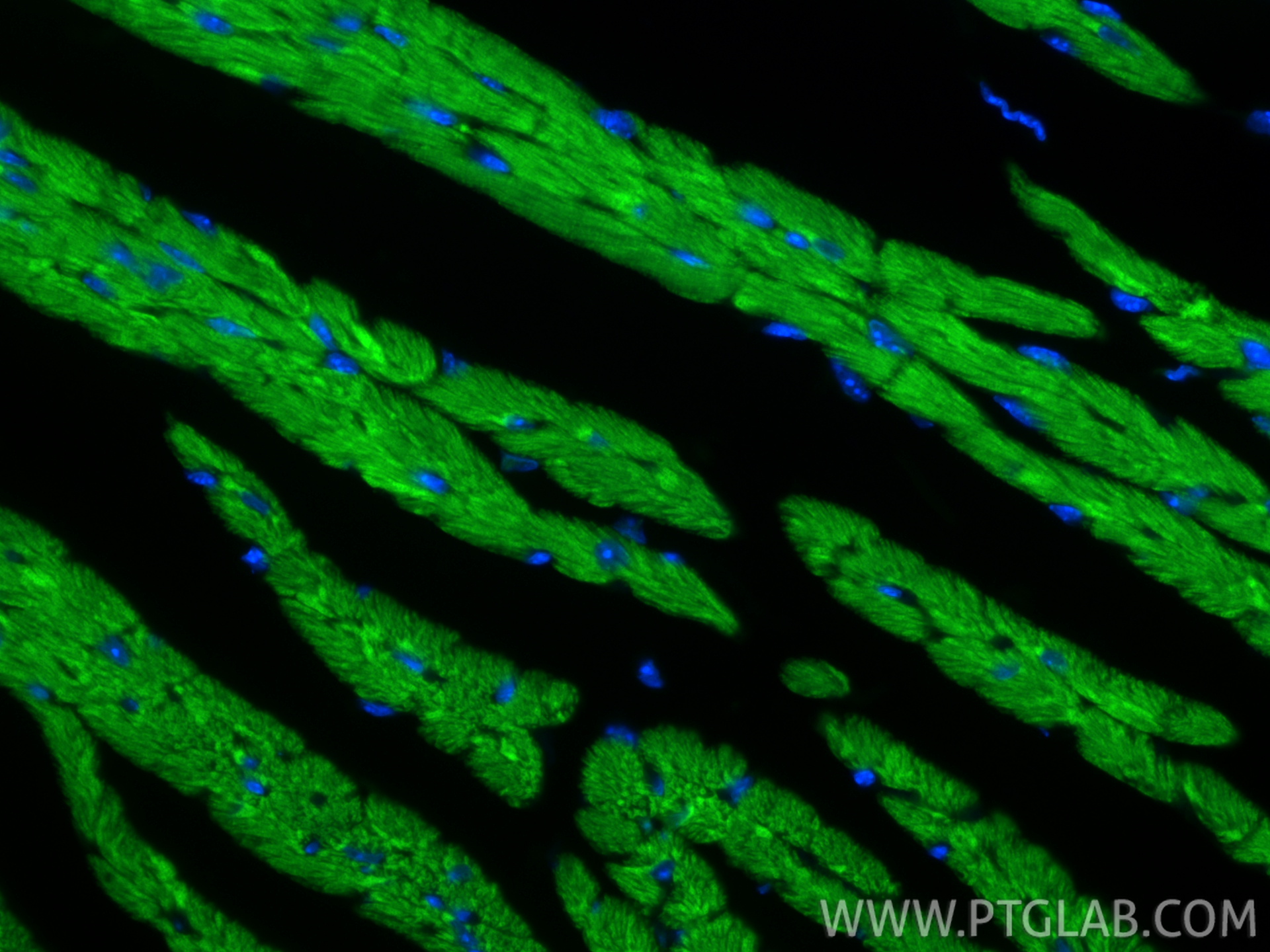 IF Staining of mouse heart using CL488-82701-3 IF Staining of mouse heart using CL488-82701-3