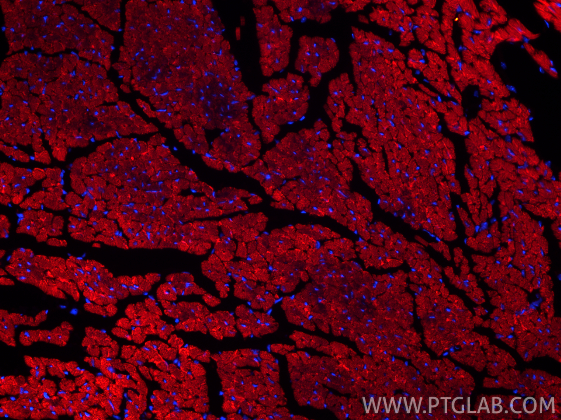 IF Staining of mouse heart using CL594-82701-3 IF Staining of mouse heart using CL594-82701-3