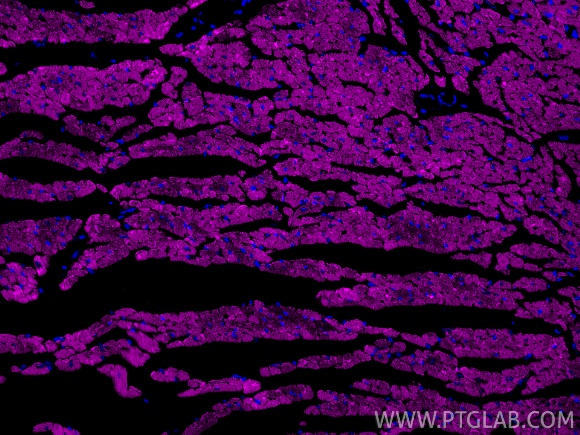 IF Staining of mouse heart using CL647-82701-3