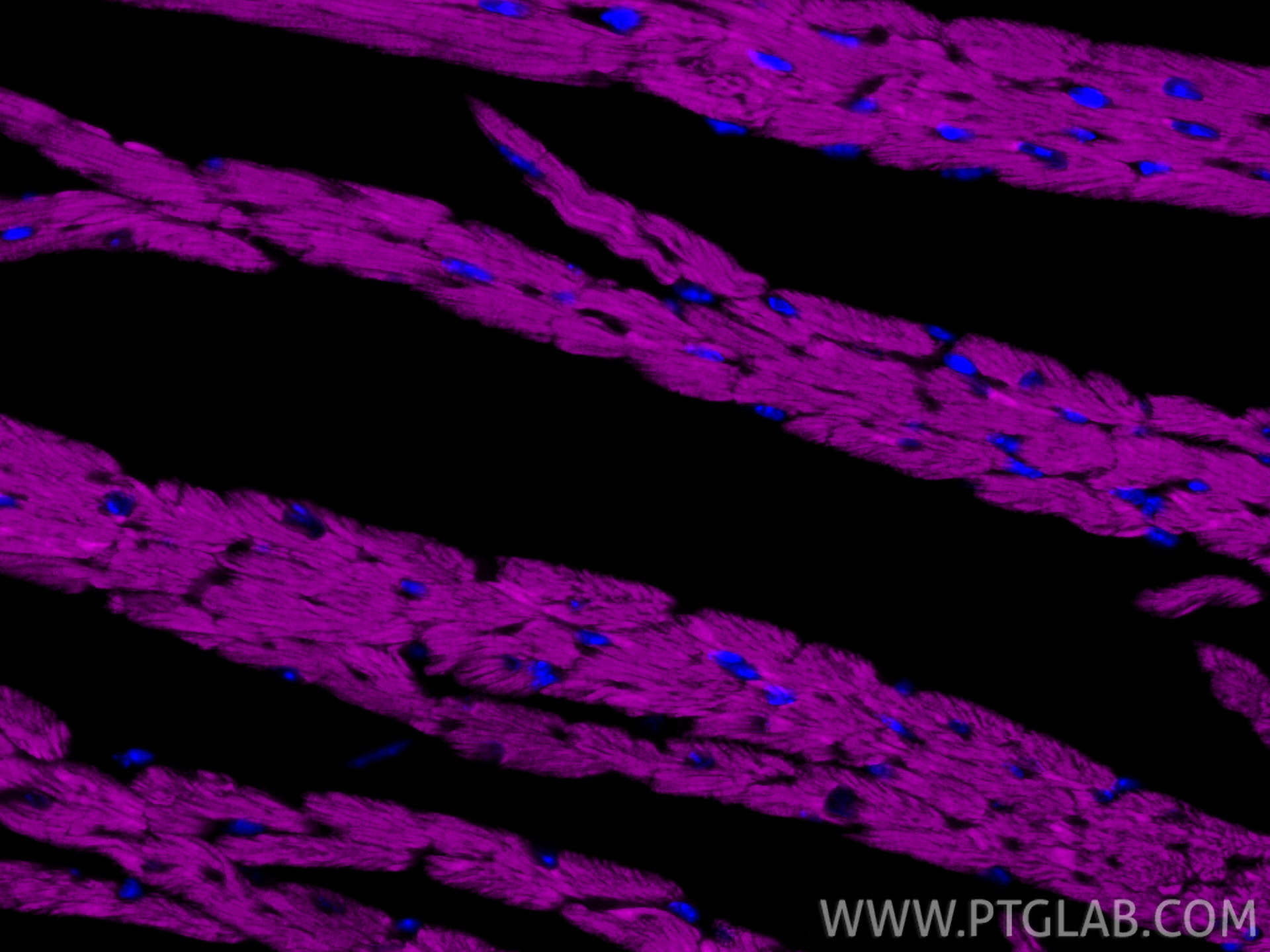 IF Staining of mouse heart using CL647-82701-3