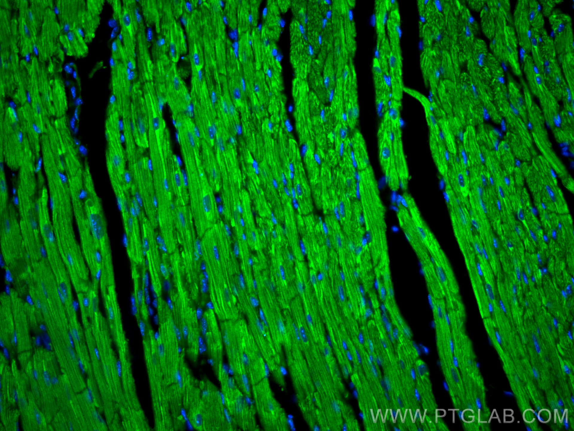 IF Staining of mouse heart using CL488-22170