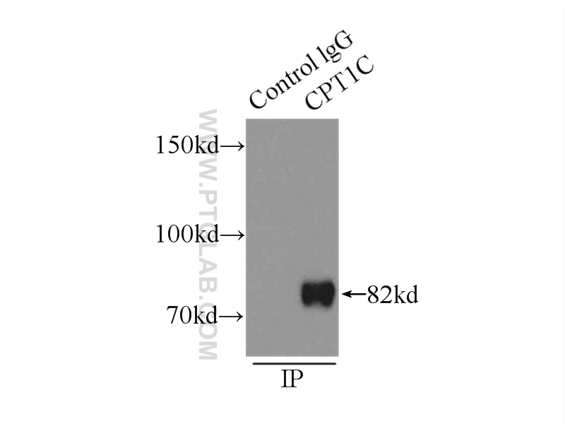 IP experiment of mouse testis using 12969-1-AP