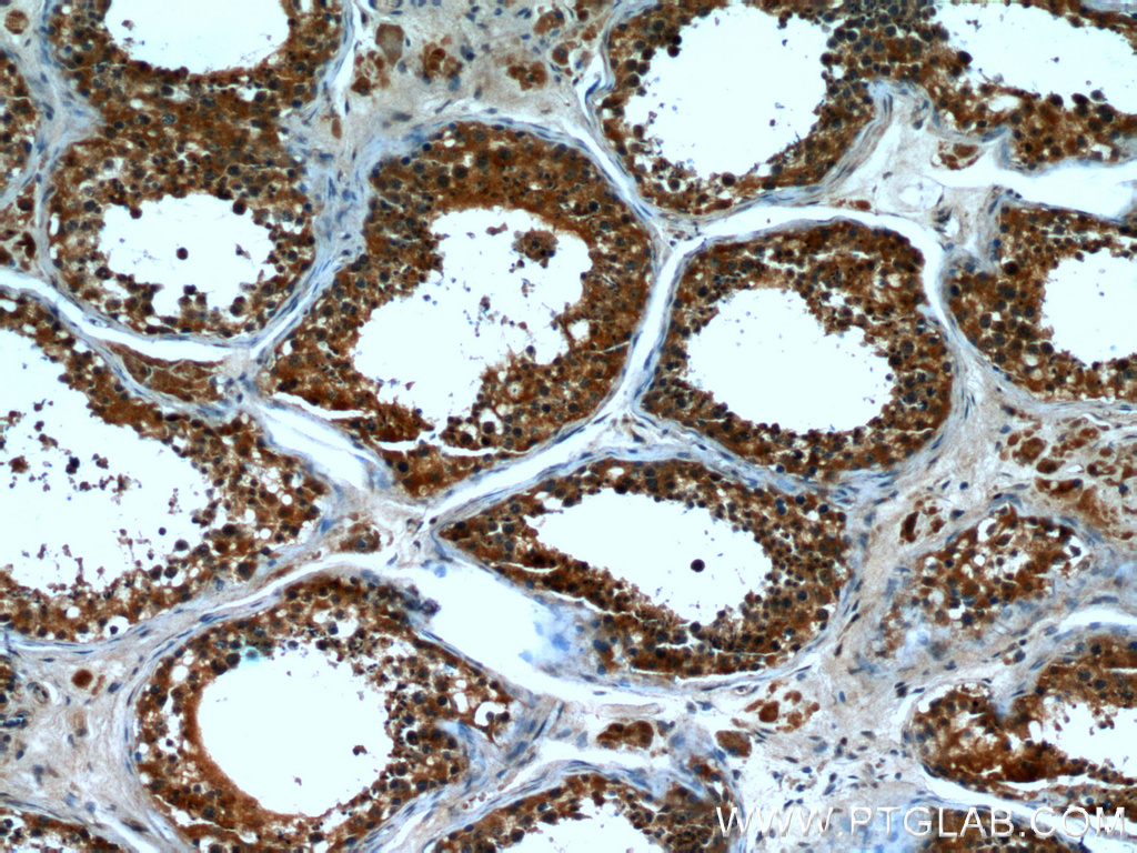 IHC staining of human testis using 66072-1-Ig