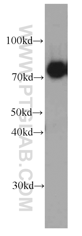 WB analysis of human brain using 66072-1-Ig (same clone as 66072-1-PBS)