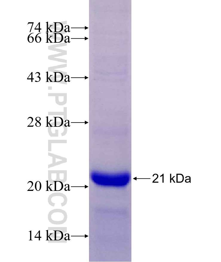 CPT1C fusion protein Ag29630 SDS-PAGE