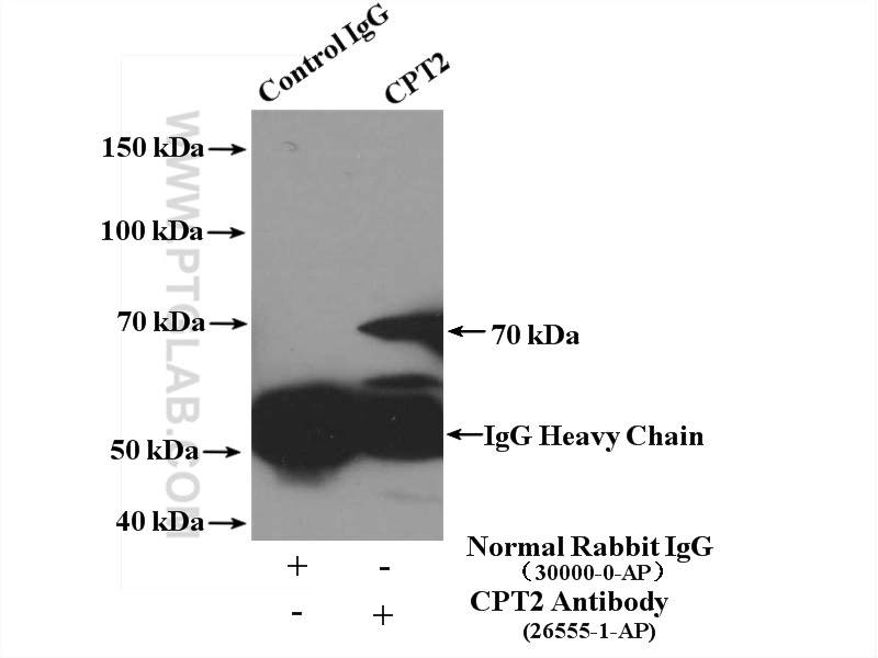 IP experiment of mouse liver using 26555-1-AP