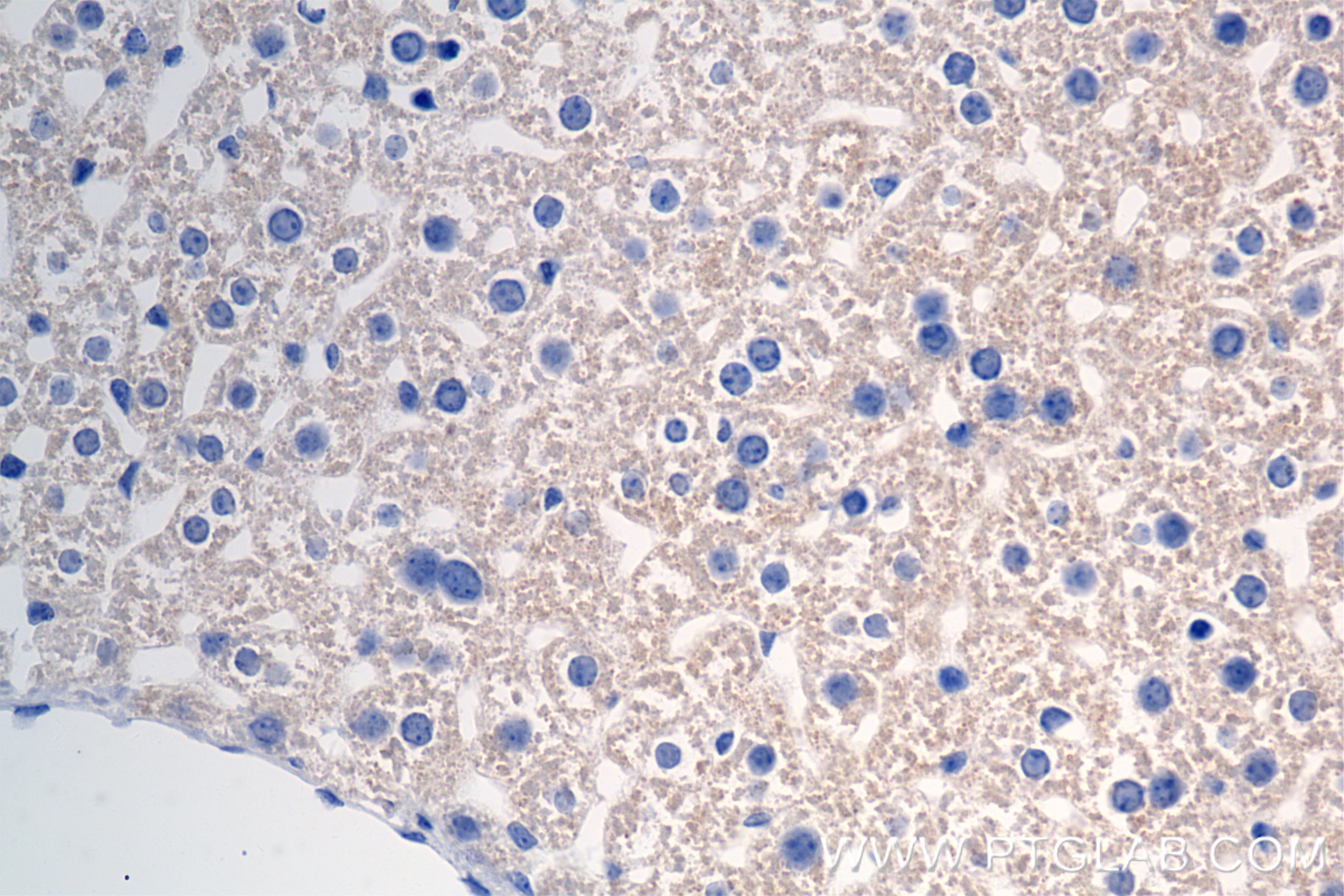 IHC staining of mouse liver using 85013-4-RR